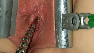 Female Urethral Sounding Orgasm Stretched & Clamped Pussy S&M Medical Play